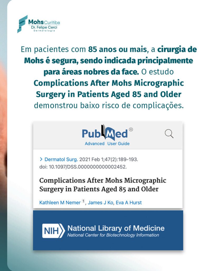 Em pacientes com 85 anos ou mais, a cirurgia de Mohs é segura, sendo indicada principalmente para áreas nobres da face. O estudo Complications After Mohs Micrographic Surgery in Patients Aged 85 and Older demonstrou baixo risco de complicações.