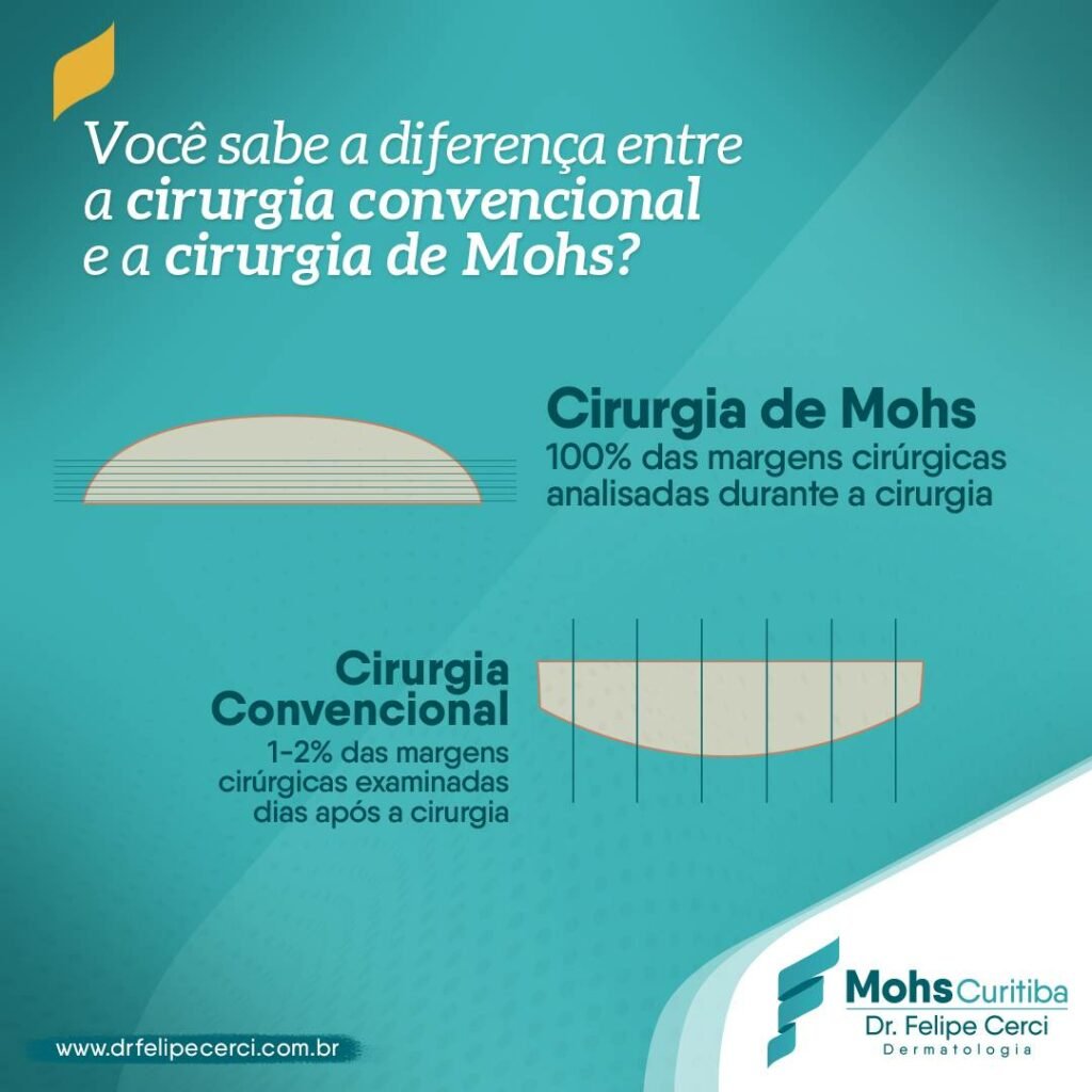 Diferença entre a cirurgia convencional e a cirurgia de Mohs