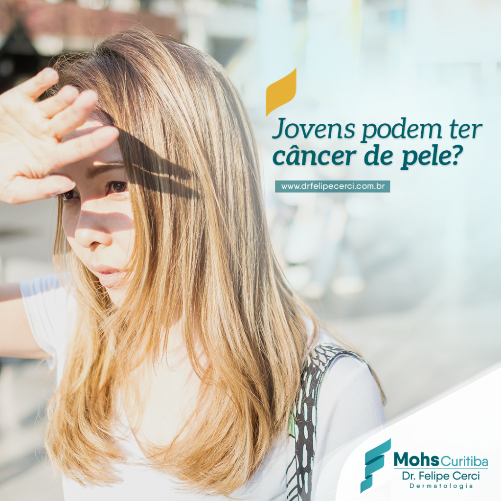 Jovens podem ter câncer de pele?