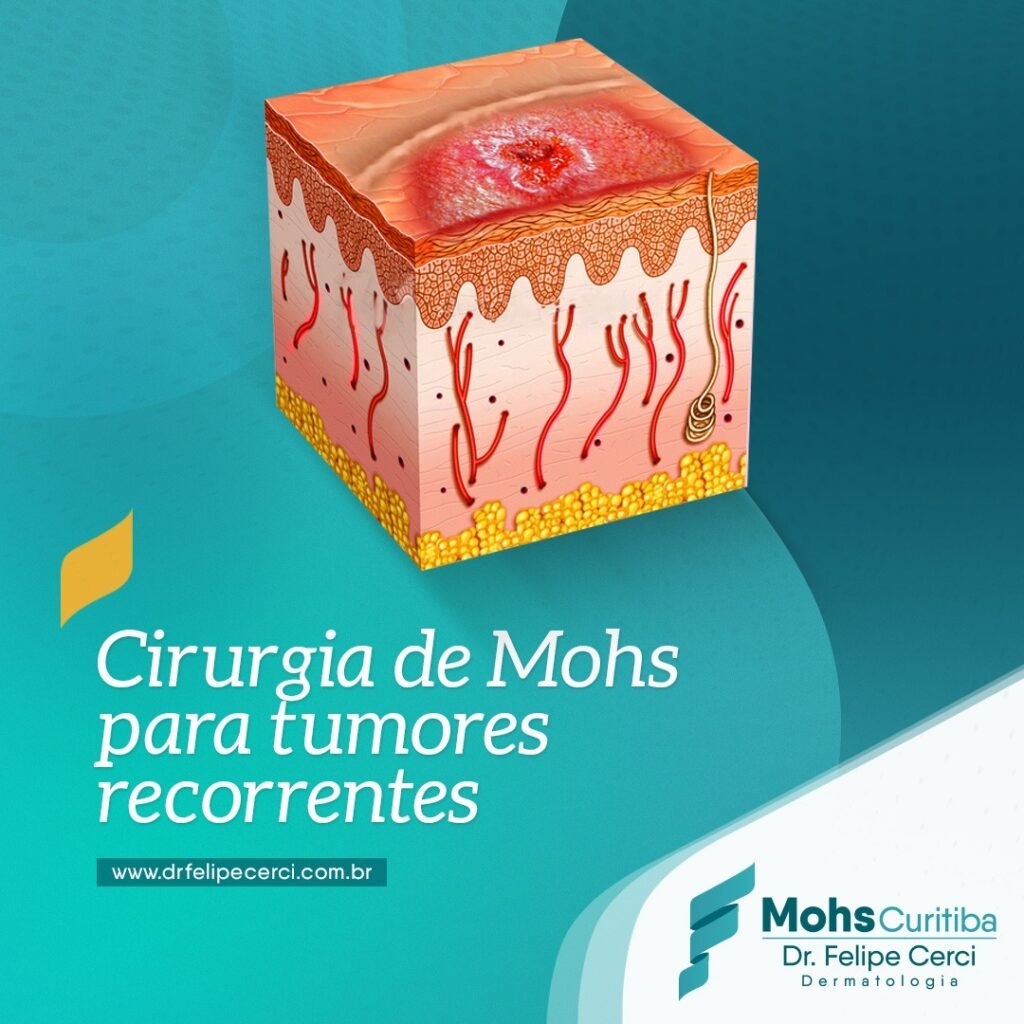 Tumores recorrentes