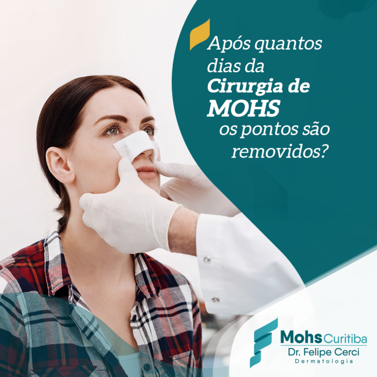 Após quantos dias da cirurgia de Mohs os pontos são removidos?