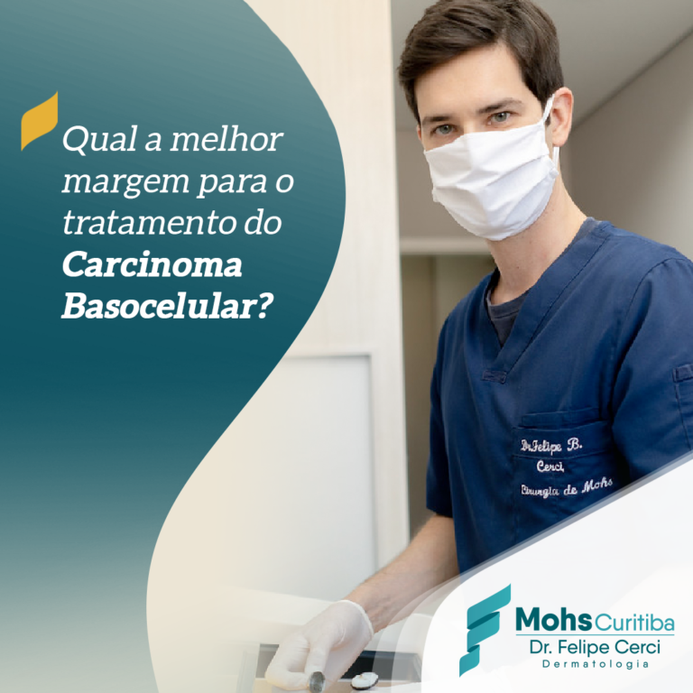 Qual a melhor margem para o tratamento do carcinoma basocelular?