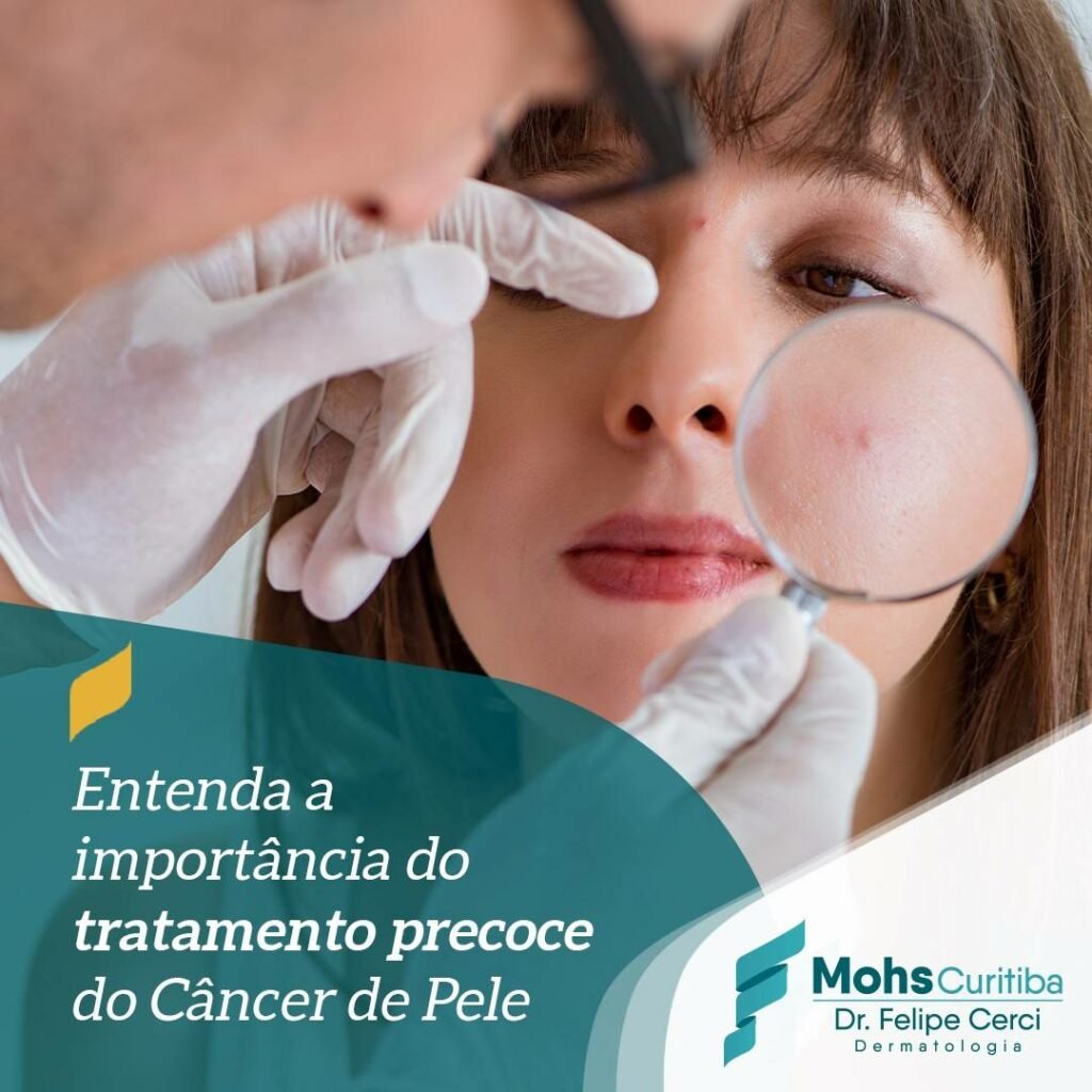 Entenda a importância da cirurgia do tratamento precoce do câncer de pele