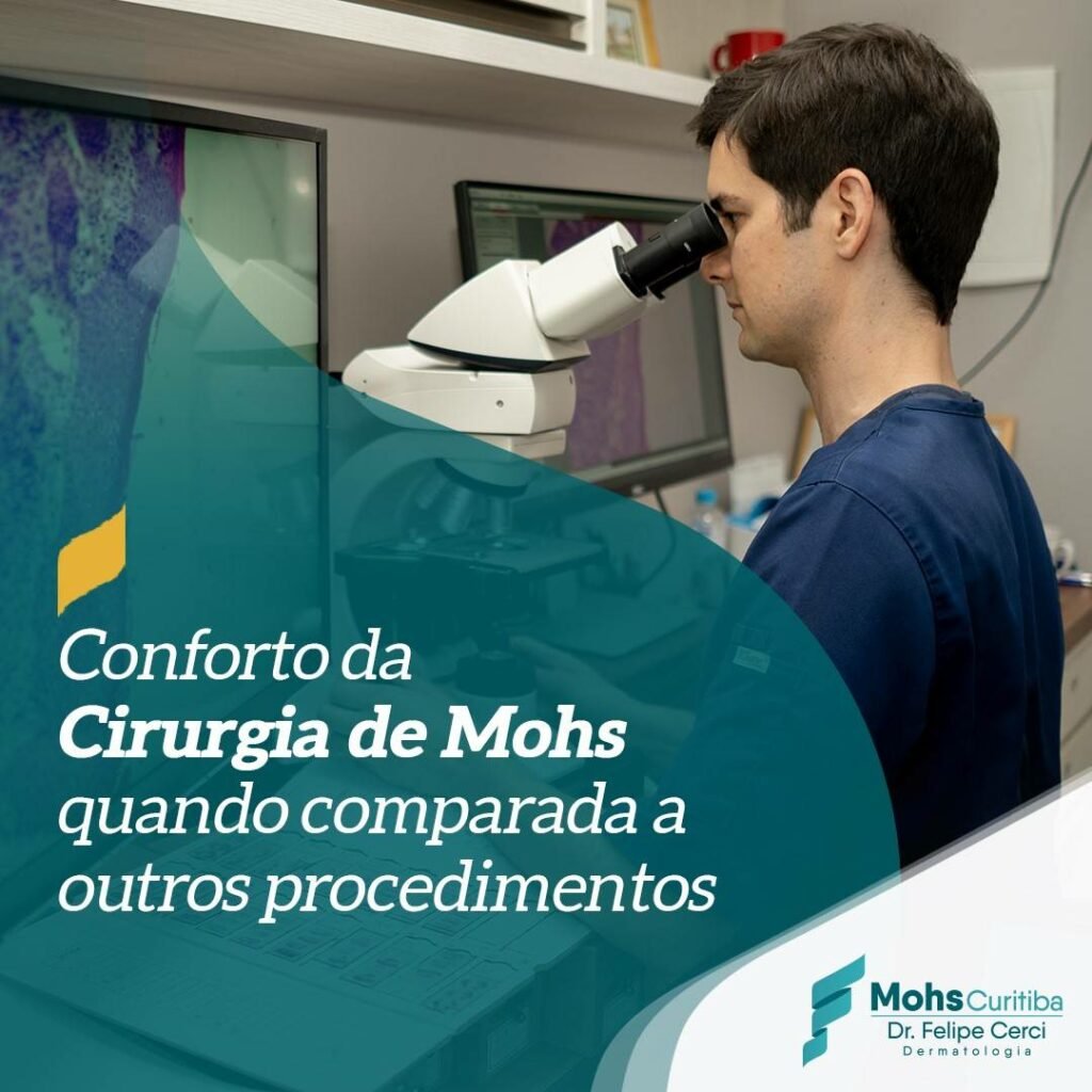 Conforto da cirurgia de Mohs quando comparado a outros procedimentos