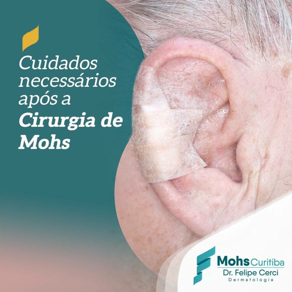 Cuidados necessários após a cirurgia de Mohs?