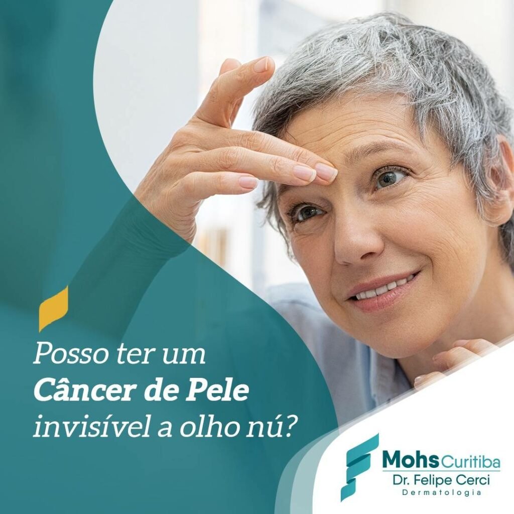 Posso ter um câncer de pele invisível a olho nú?