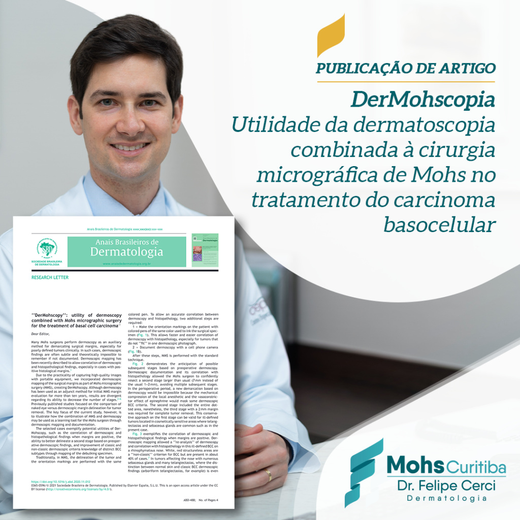 Publicação de artigo – “DerMohscopia: utilidade da dermatoscopia combinada à cirurgia micrográfica de Mohs no tratamento do carcinoma basocelular”,