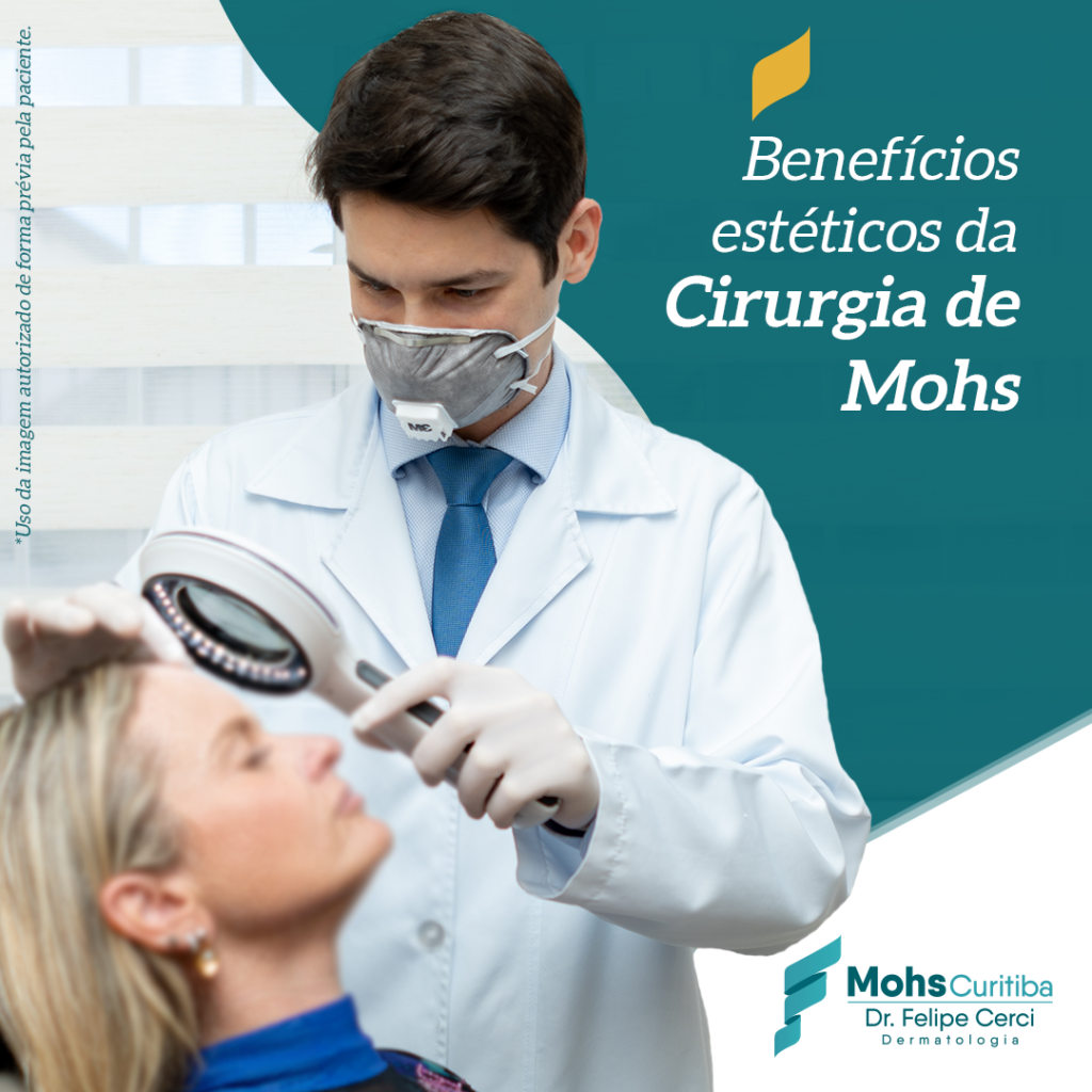 Benefícios estéticos da Cirugia de Mohs