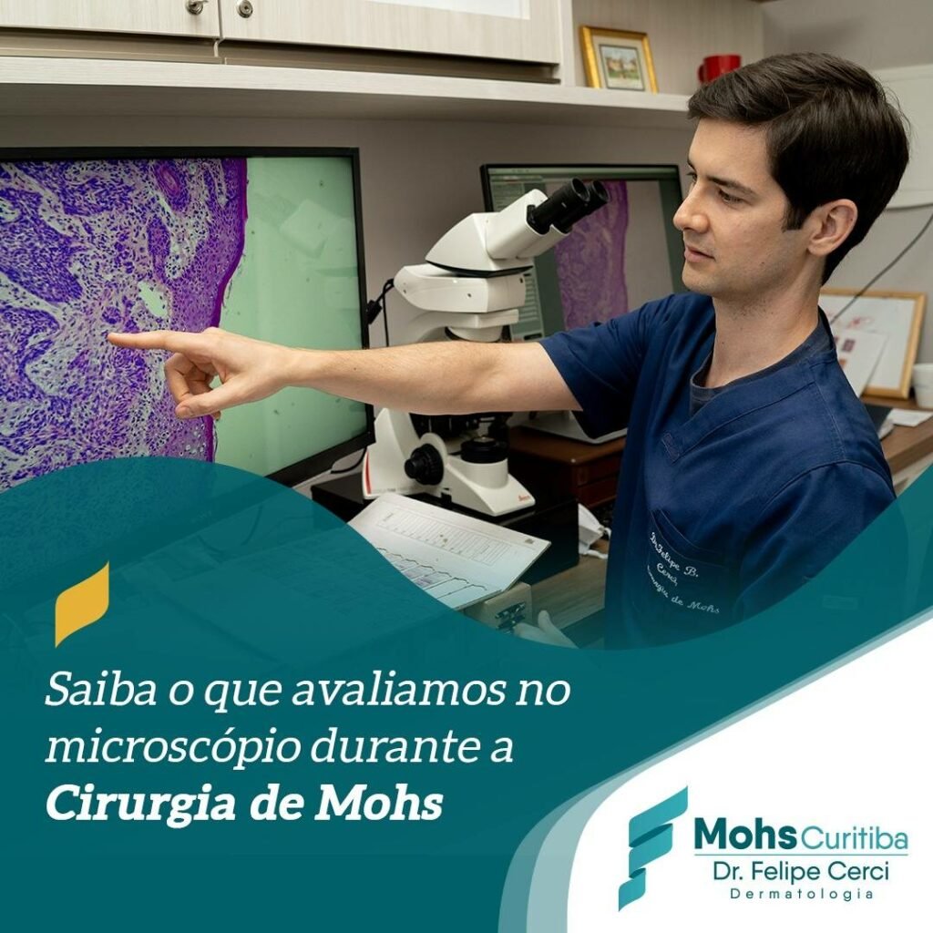 Saiba o que avaliamos no microscópio durante a Cirurgia de Mohs?