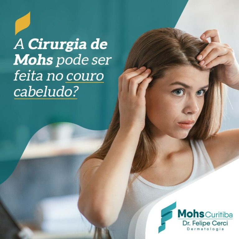 A cirurgia de Mohs pode ser feita no couro cabeludo?