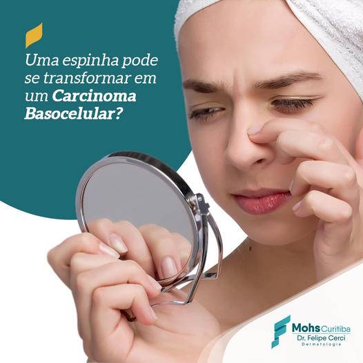 Uma espinha pode se transformar em carcinoma basocelular?