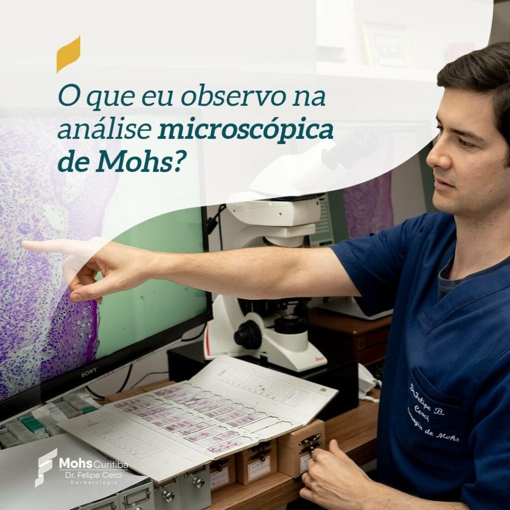 O que eu observo na análise microscópica de Mohs?