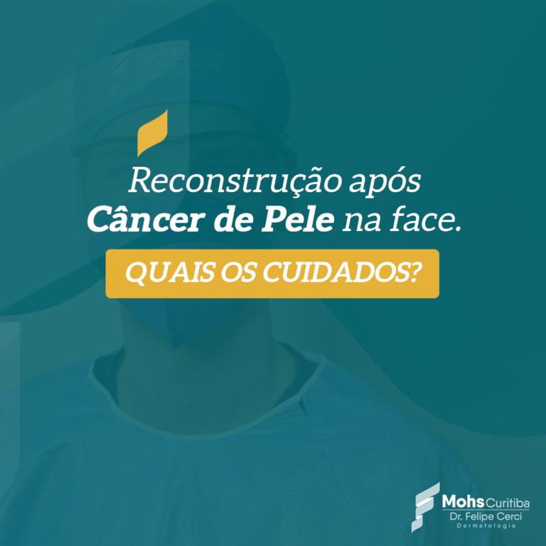 Reconstrução após câncer de pele na face. Quais os cuidados?