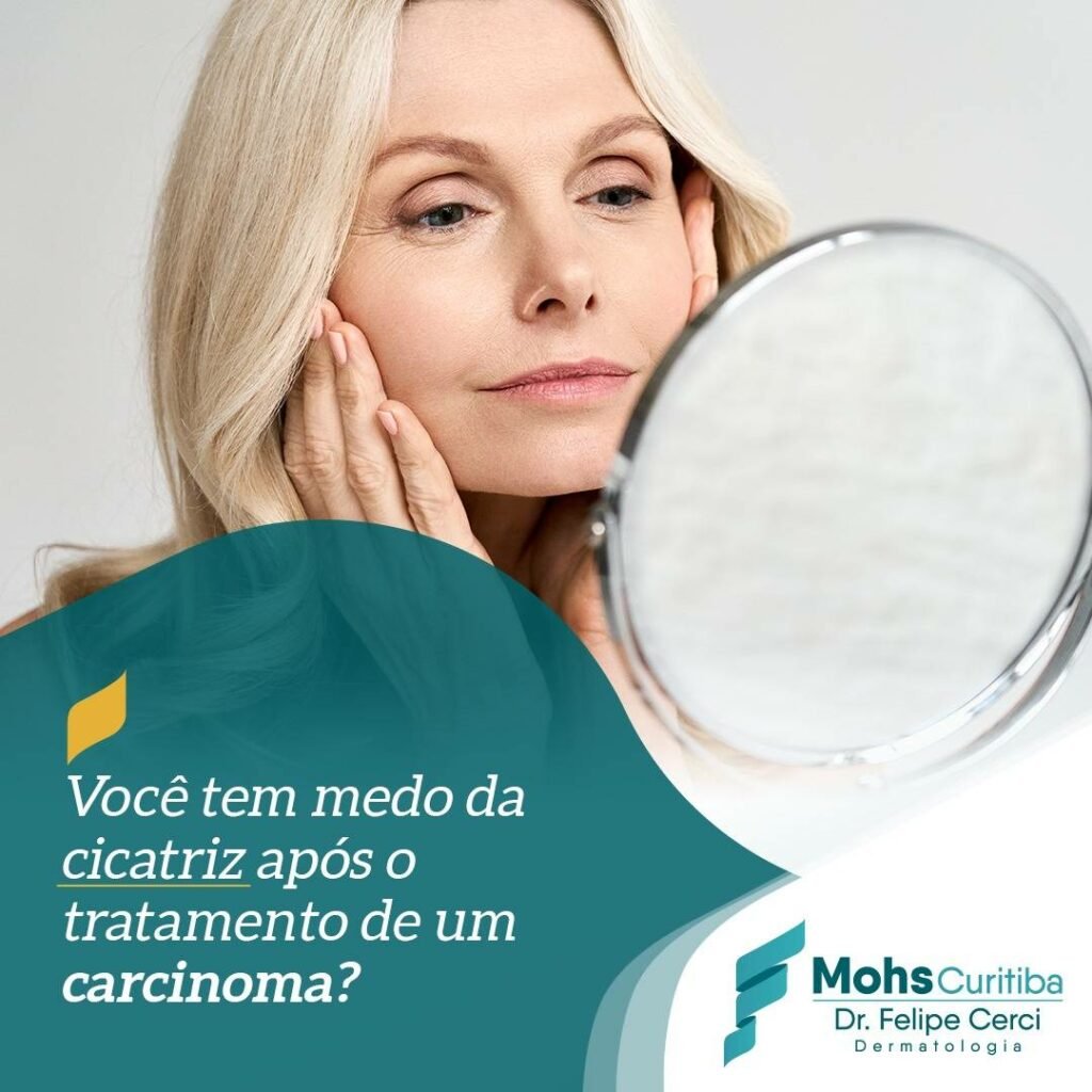 Você tem medo da cicatriz após o tratamento de um carcinoma?