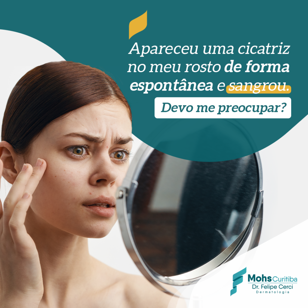 Apareceu uma cicatriz de forma espontânea no meu rosto e sangrou. Devo me preocupar?