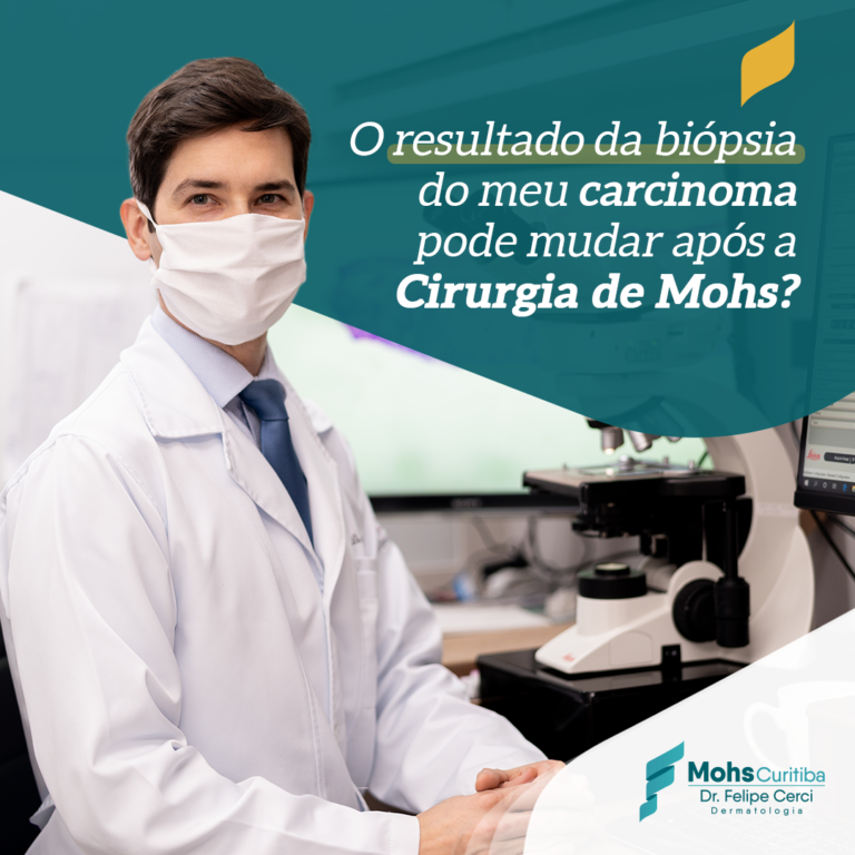 O resultado da biópsia do meu carcinoma pode mudar após a Cirurgia de Mohs?