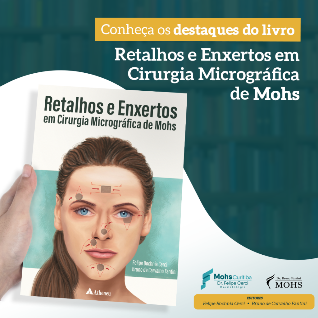 Conheça os destaques do livro “Retalhos e Enxertos em Cirurgia Micrográfica de Mohs”