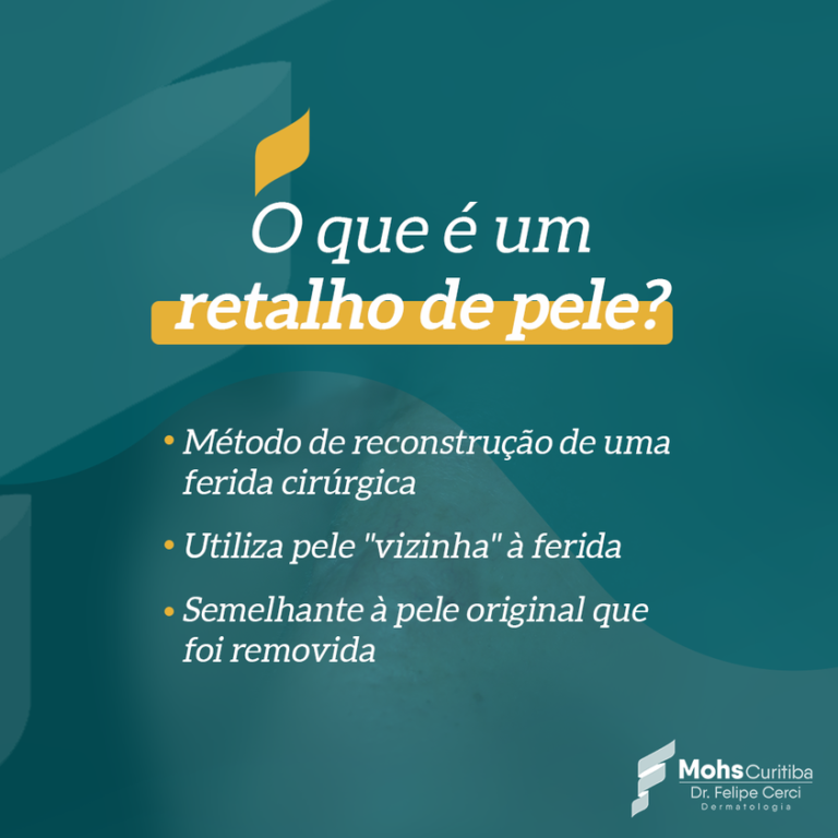 O que é um “Retalho de Pele”?