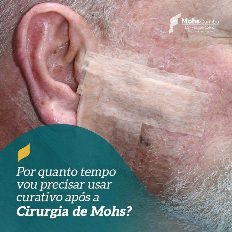 Por quanto tempo devo usar curativo após a Cirurgia de Mohs?