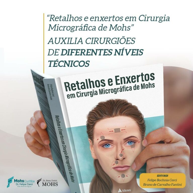 Retalhos e Enxertos em Cirurgia de Mohs auxilia cirurgiões de diferentes níveis técnicos