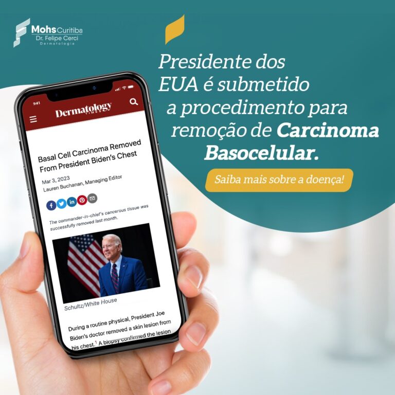 Presidente dos EUA é submetido a procedimento para remoção de Carcinoma Basocelular