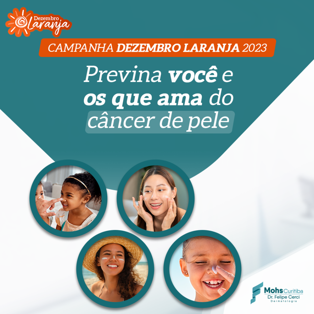 Dezembro Laranja: Previna você e os que ama do Câncer de Pele