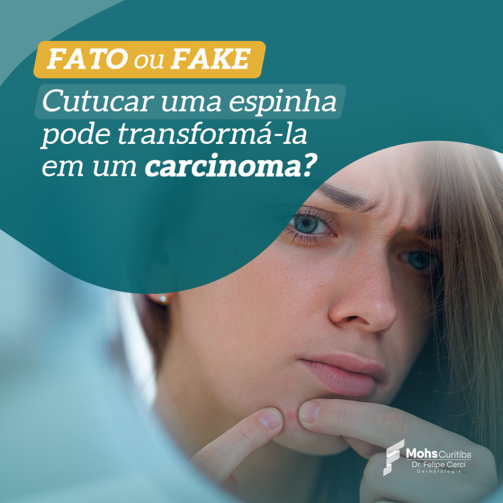 FATO OU FAKE: CUTUCAR UMA ESPINHA PODE TRANSFORMÁ-LA EM UM CARCINOMA?