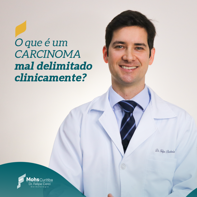 O QUE É UM CARCINOMA MAL DELIMITADO CLINICAMENTE?