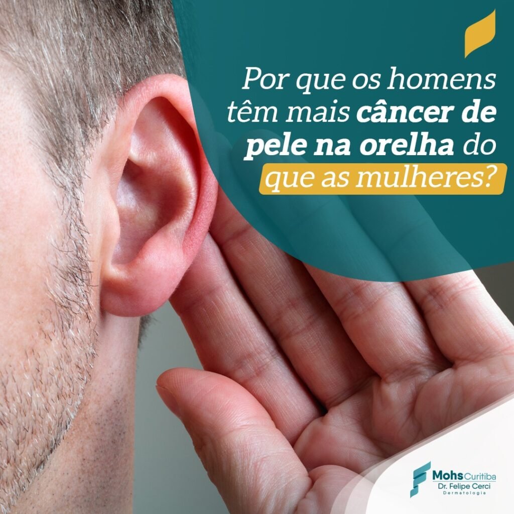 Por que os homens têm mais câncer na orelha do que as mulheres?