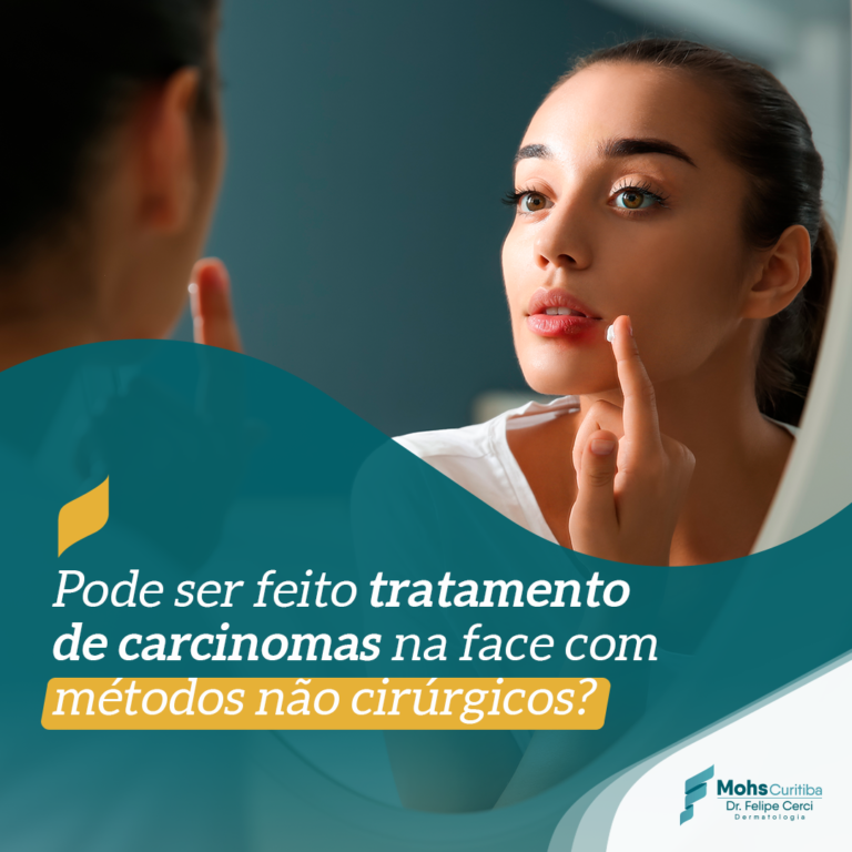 Pode ser feito tratamento de carcinomas na face com métodos não cirúrgicos?