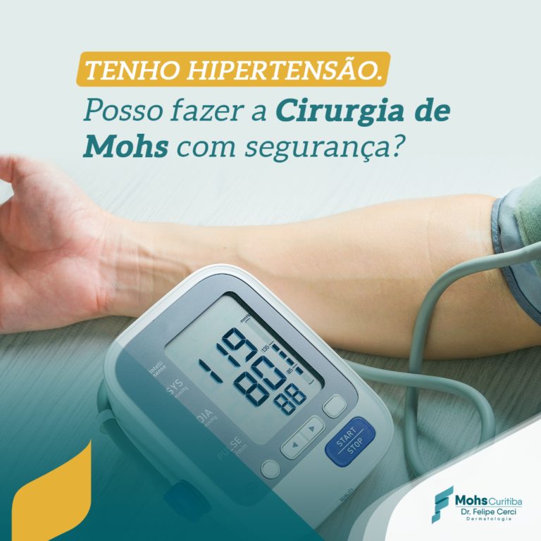 TENHO HIPERTENSÃO. POSSO FAZER A CIRURGIA DE MOHS COM SEGURANÇA?