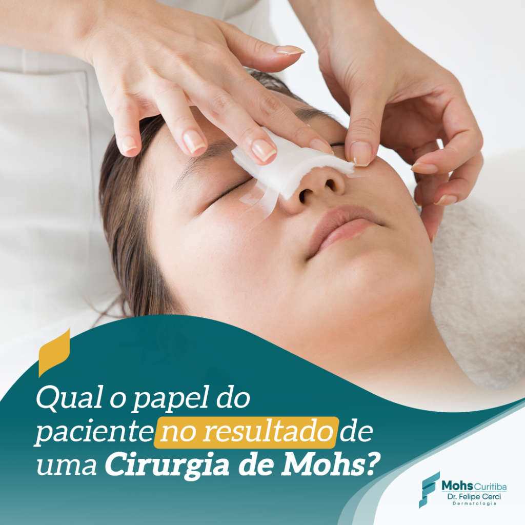 QUAL O PAPEL DO PACIENTE NO RESULTADO DE UMA CIRURGIA DE MOHS?