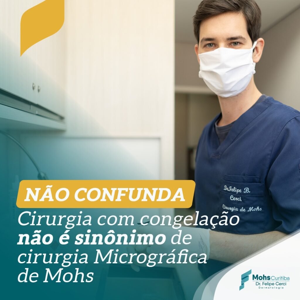 Não confunda. Cirurgia com congelação não é sinônimo de Cirurgia Micrográfica de Mohs