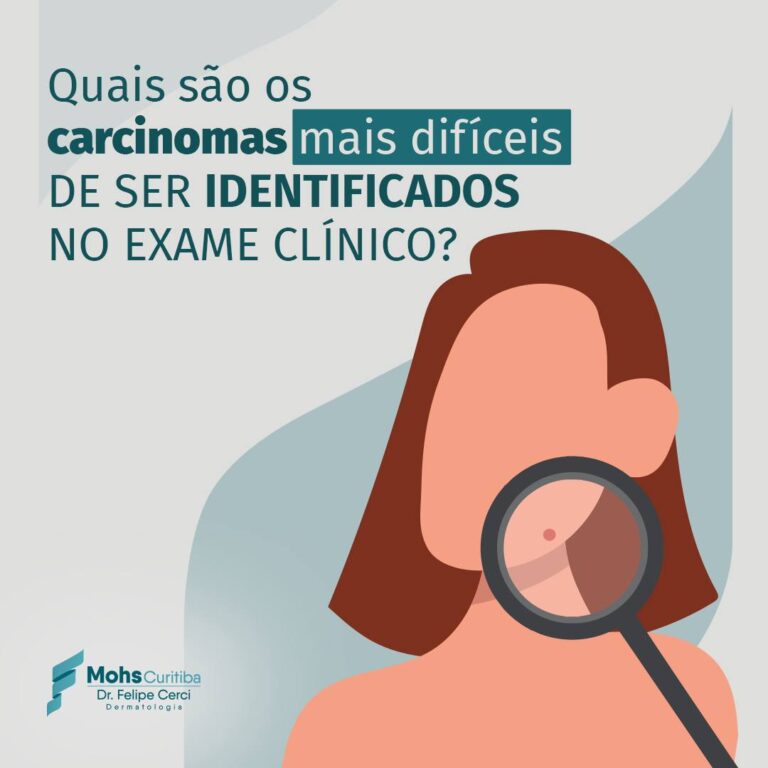 Quais são os carcinomas mais difíceis de ser identificados no exame clínico?