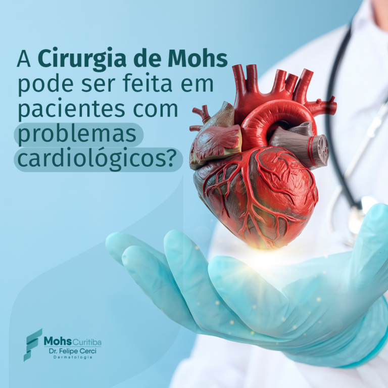 A CIRURGIA DE MOHS PODE SER FEITA EM PACIENTES COM PROBLEMAS CARDIOLÓGICOS?