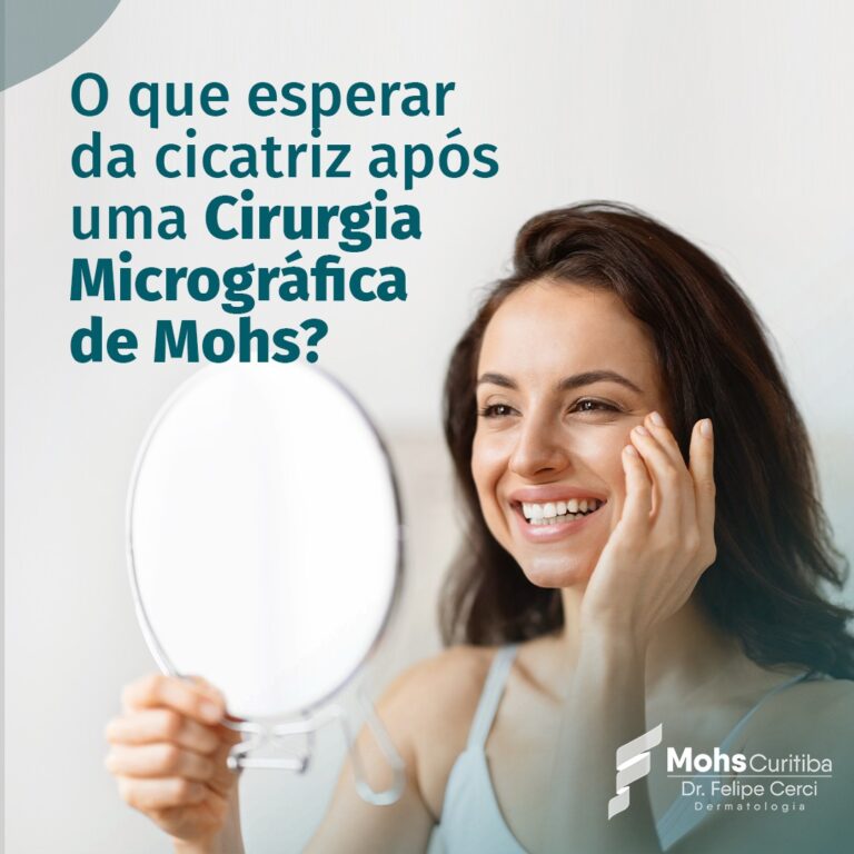 O que esperar de uma cicatriz após uma Cirurgia Micrográfica de Mohs?