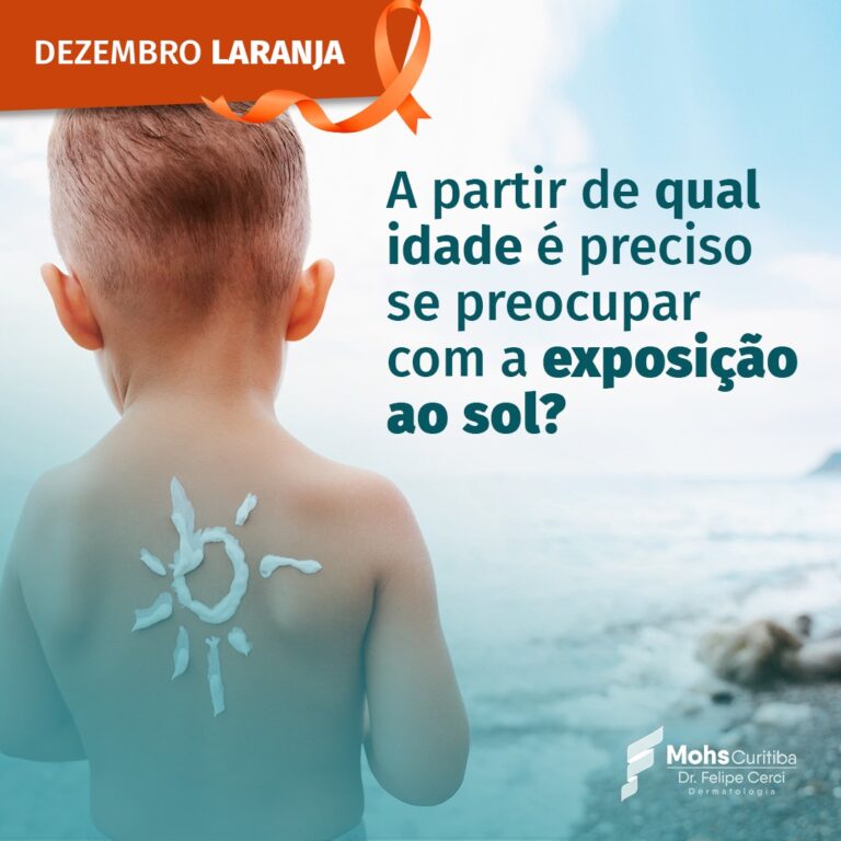 A partir de qual idade é preciso se preocupar com a exposição solar?