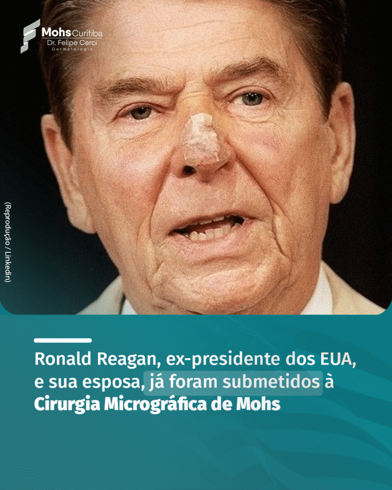 RONALD E NANCY REAGAN, EX-PRESIDENTE E PRIMEIRA DAMA DOS EUA, JÁ FORAM SUBMETIDOS A CIRURGIA DE MOHS
