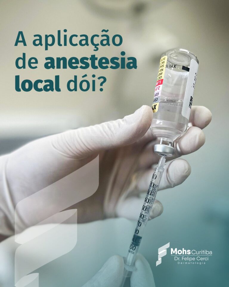 A aplicação de anestesia local dói?