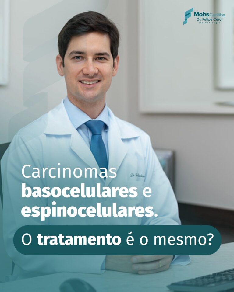 Carcinomas basocelulares e espinocelulares. O tratamento é o mesmo?
