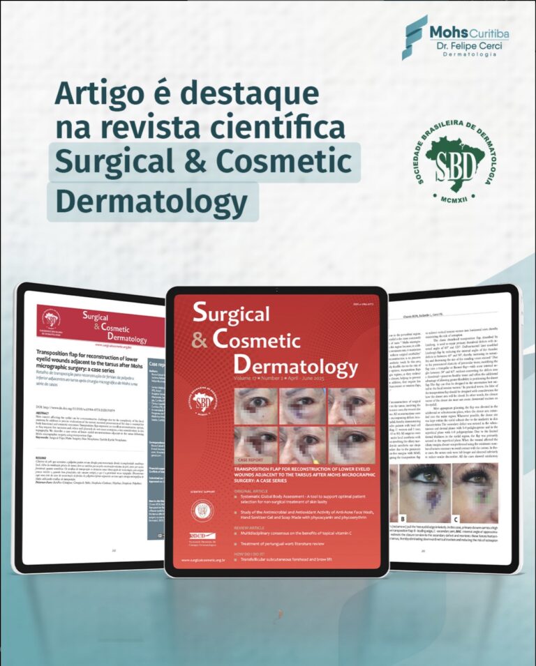 Artigo é destaque na revista científica Surgical & Cosmetic Dermatology