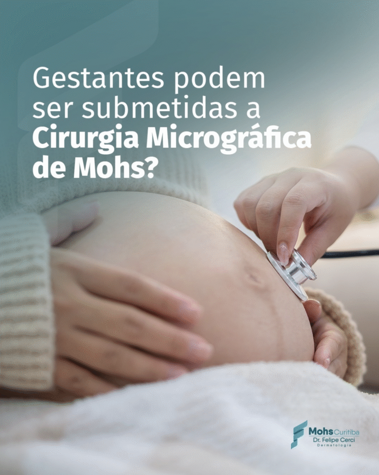 Gestantes podem ser submetidas a Cirurgia Micrográfica de Mohs?