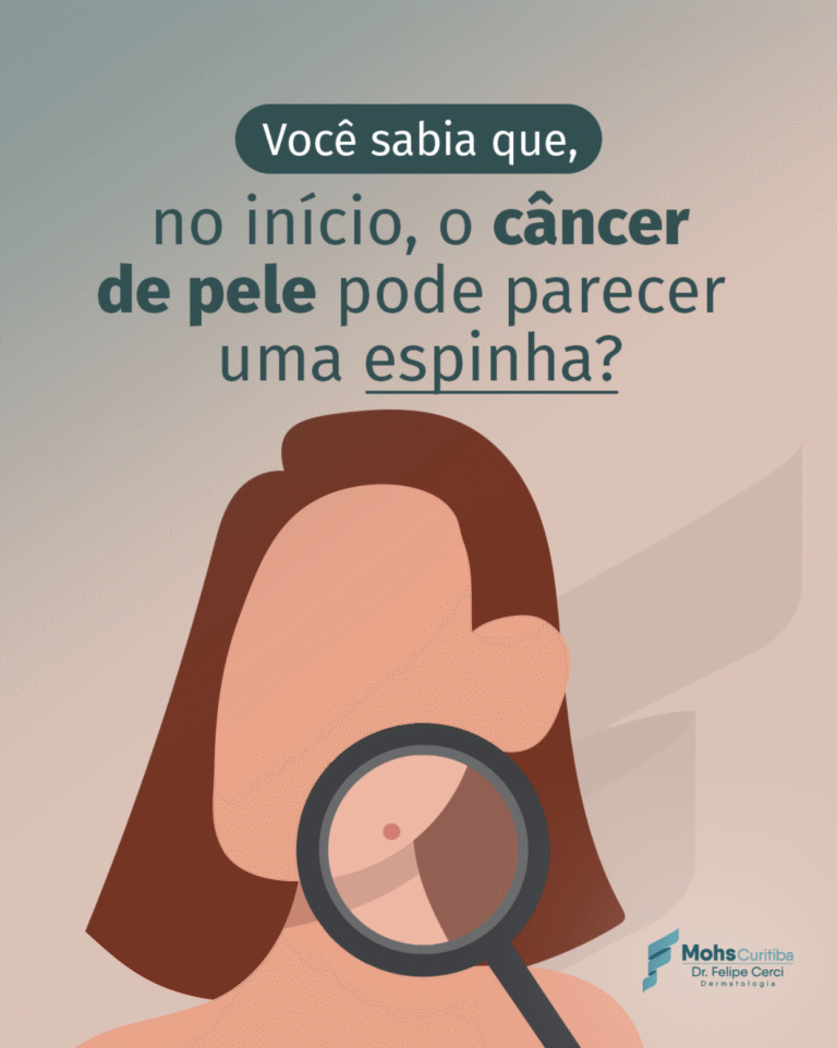 Você sabia que, no início, o câncer de pele pode parecer uma espinha?
