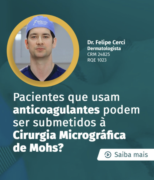 Pacientes que usam anticoagulantes podem ser submetidos à Cirurgia Micrográfica de Mohs?