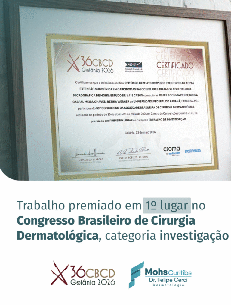 Trabalho premiado em 1º lugar no Congresso Brasileiro de Cirurgia Dermatológica, categoria investigação