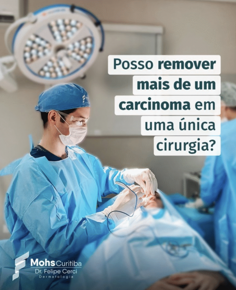 Posso remover mais de um carcinoma em uma única cirurgia?