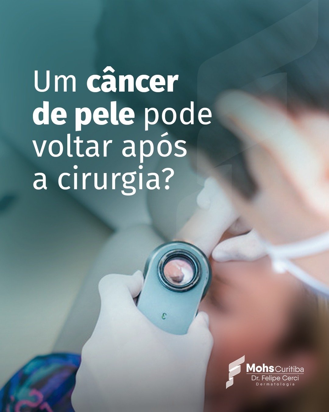 Dermatologista examinando a pele do rosto de um paciente com um dermatoscópio, com a pergunta: um câncer de pele pode voltar após a cirurgia?