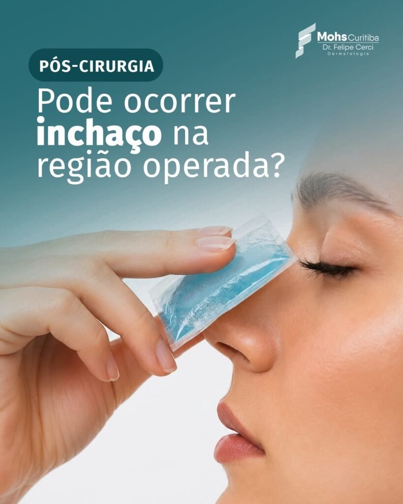 Pode ocorrer inchaço na região operada após a cirurgia de Mohs?