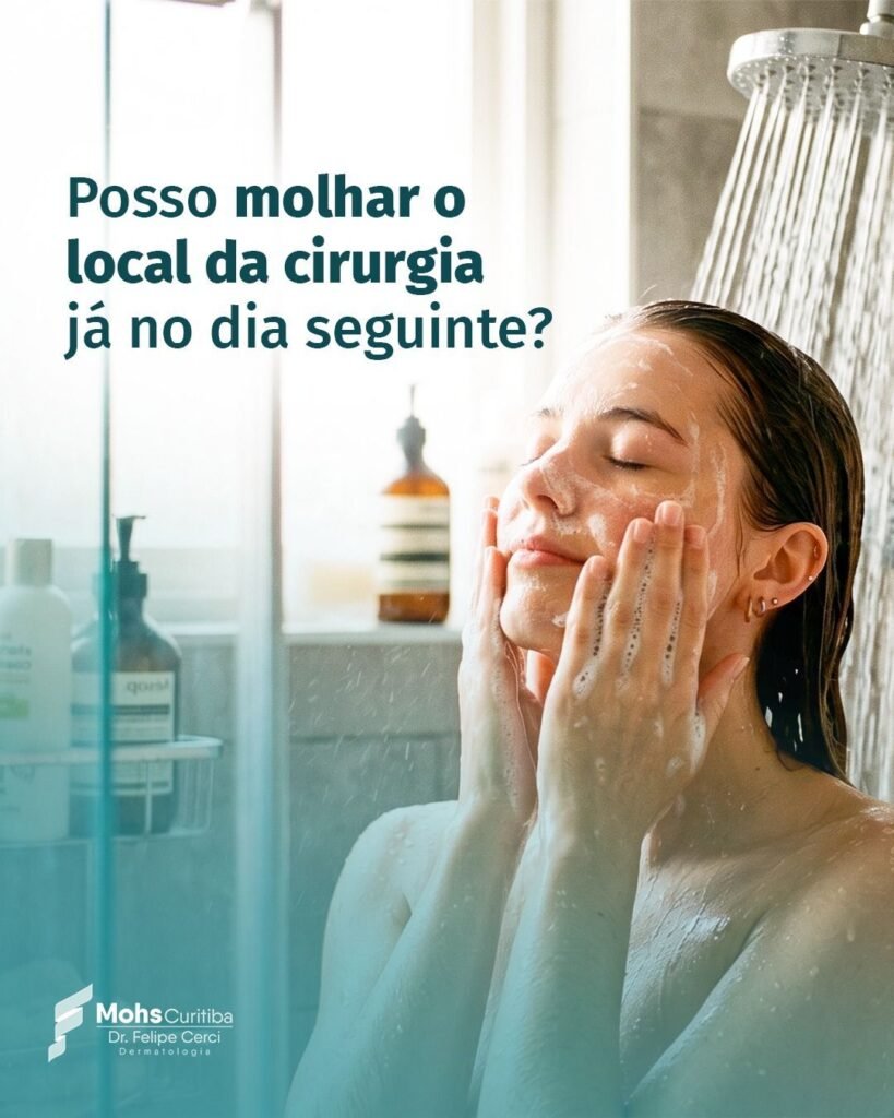 Posso molhar o local da cirurgia já no dia seguinte?